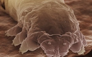 Read more about the article Demodex mites and human skin