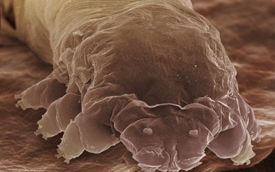 Demodex mites and human skin - Ozderm