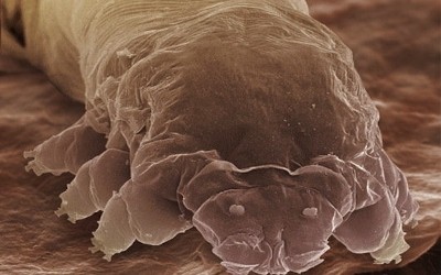 mites on humans