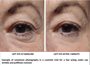 Read more about the article Before and after photos in cosmetic trials