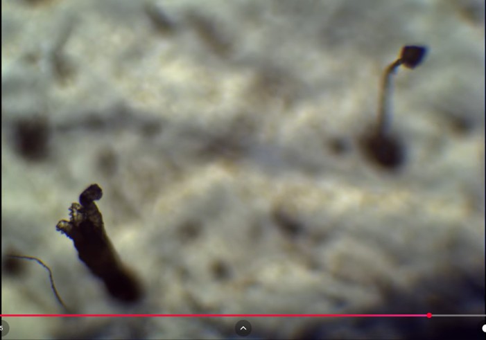 You are currently viewing Demodex mites and human skin